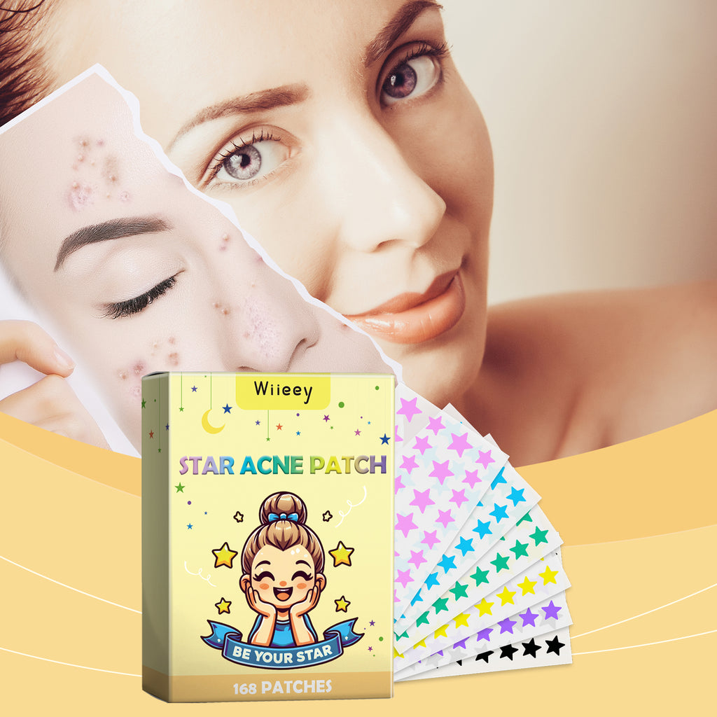 Patch anti-acné étoiles, Réduit l'acné et les marques d'acné, Nettoie le visage, Acné à bouche fermée, Patch anti-acné portable de dessin animé