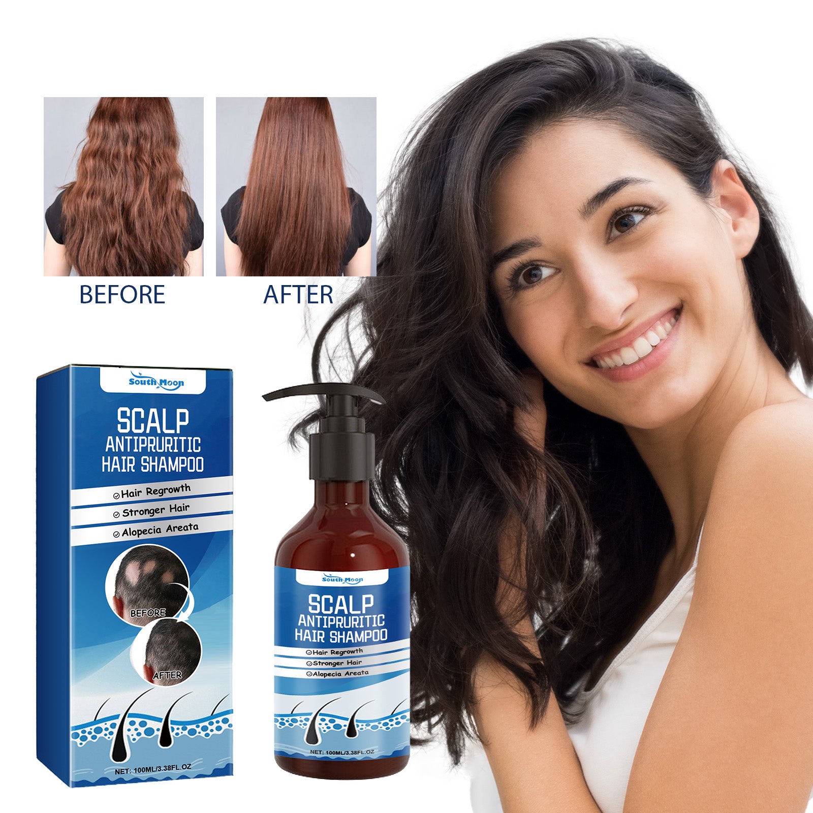 Shampoing Capillaire Antipruritique Cuir Chevelu, Shampoing Démêlant Cheveux Et Hydratant Cuir Chevelu Cheveux Denses Anti-Fixatif