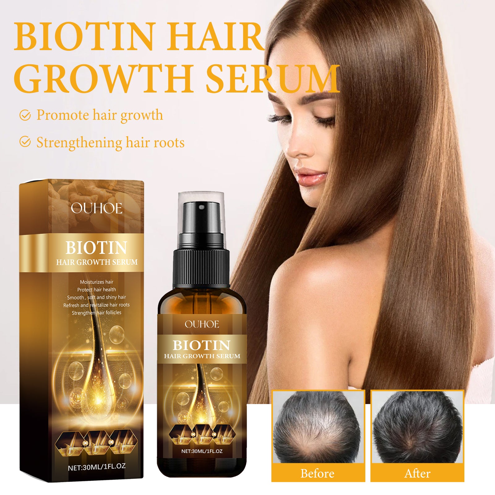 Sérum de croissance capillaire à la biotine OUHOE, nourrit la racine des cheveux, répare les cheveux, tempérament irritable, prévient la chute des cheveux