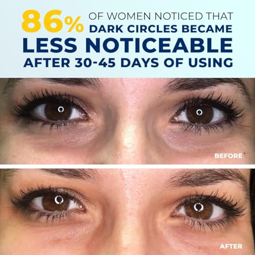 Crème anti-âge visage et cou PENEBELLA Lift & Firm