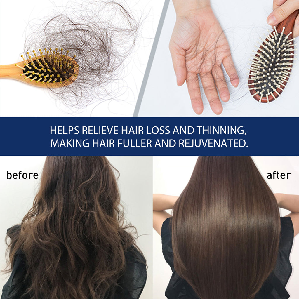 Shampoing Capillaire Antipruritique Cuir Chevelu, Shampoing Démêlant Cheveux Et Hydratant Cuir Chevelu Cheveux Denses Anti-Fixatif