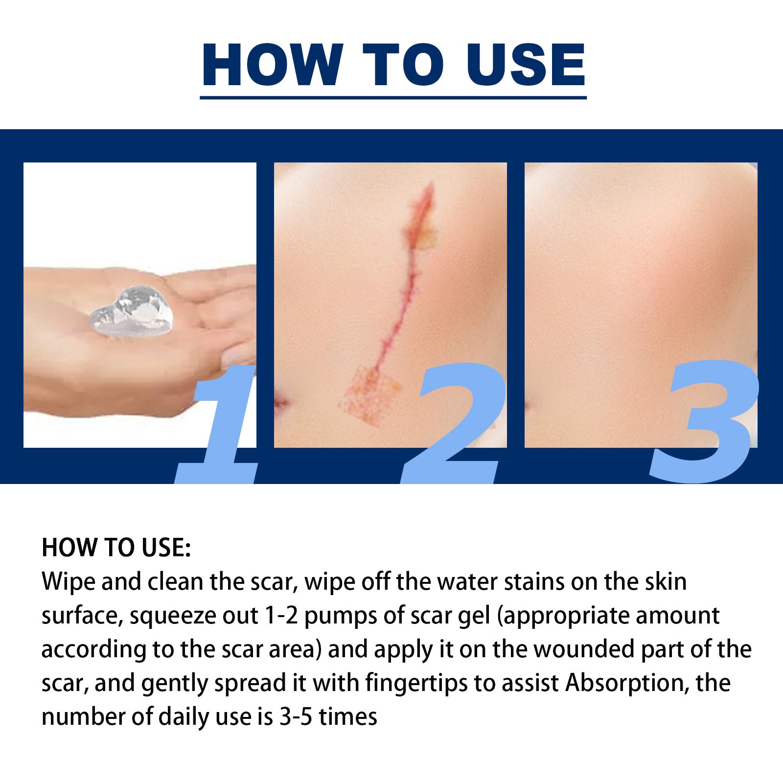 Gel réparateur de cicatrices, répare et hydrate la peau, gel lissant pour le soin des cicatrices