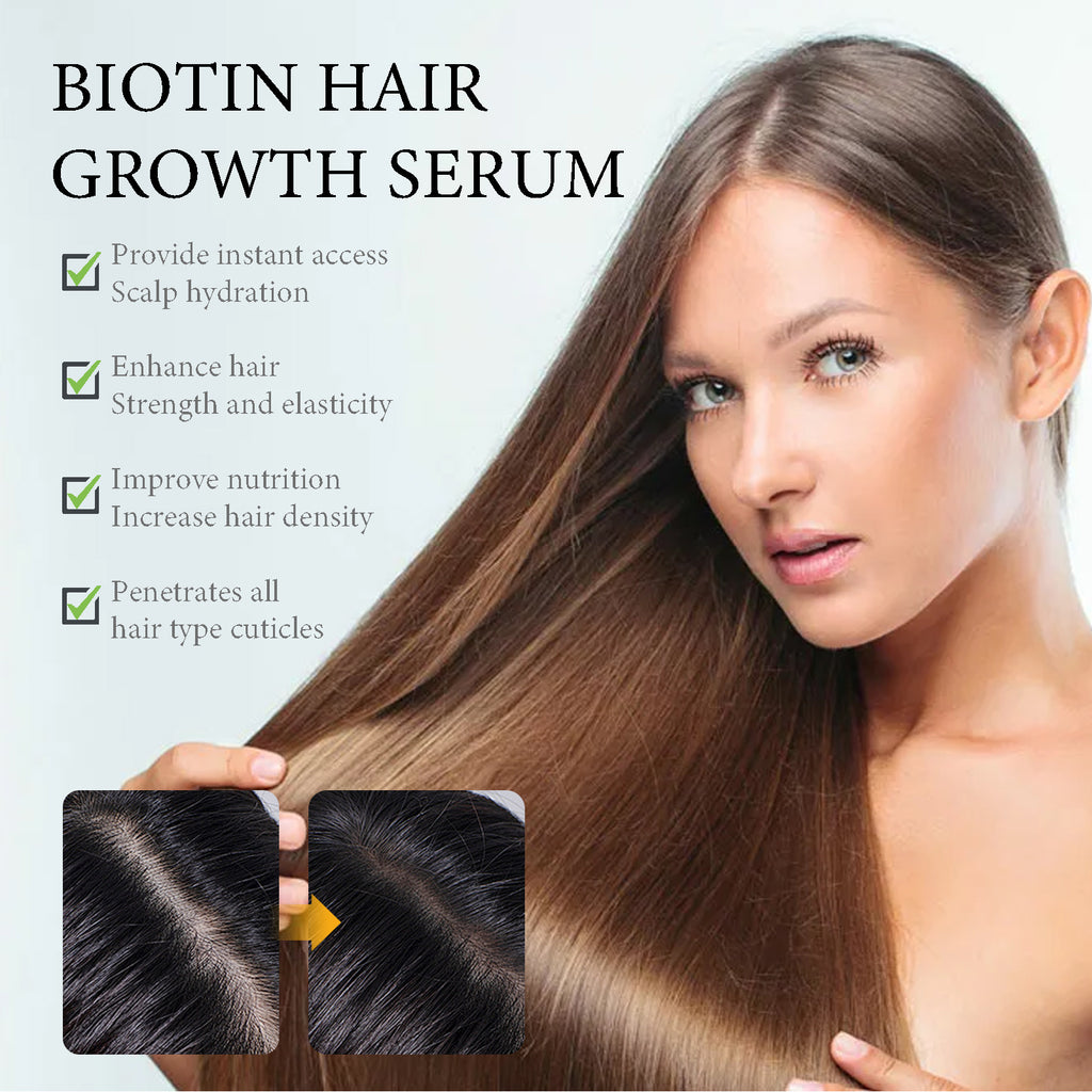Sérum de croissance capillaire à la biotine OUHOE, nourrit la racine des cheveux, répare les cheveux, tempérament irritable, prévient la chute des cheveux