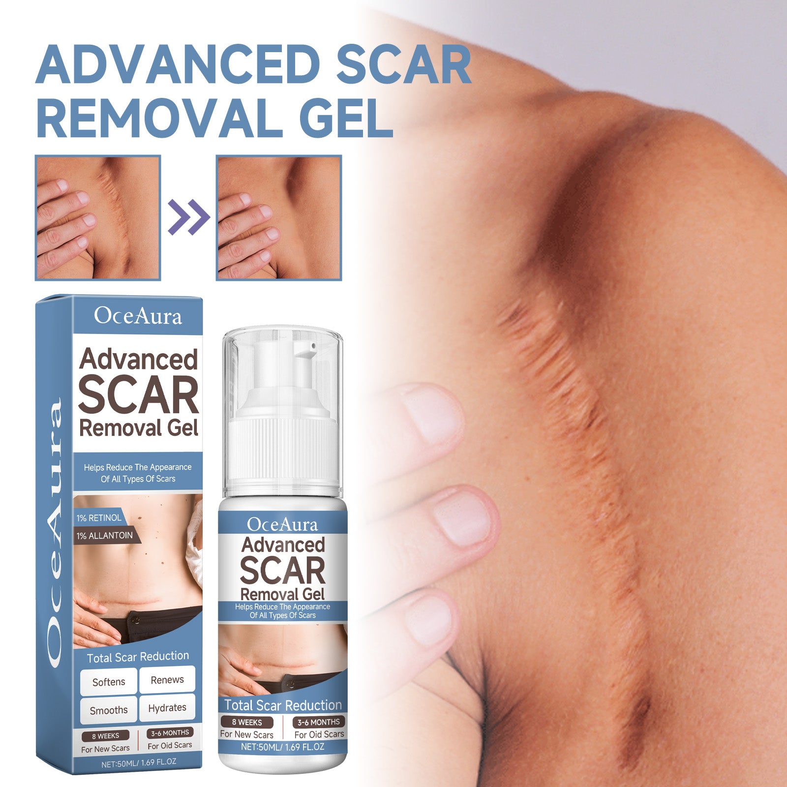 Gel réparateur éclaircissant pour cicatrices Oceaura – Hydrate et lisse la peau, répare les cicatrices chirurgicales, gel de soin post-grossesse